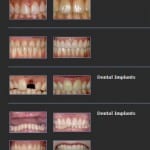 Dr. Bailey stock smile gallery from Prosites