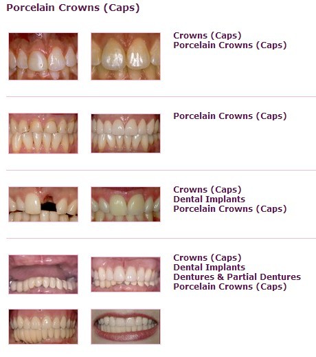 Dr. Cheung stock smile gallery from Prosites