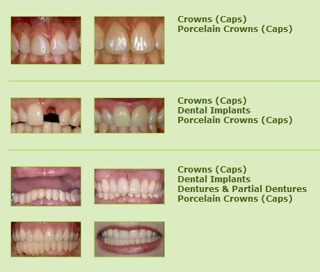 Another stock smile gallery from Prosites