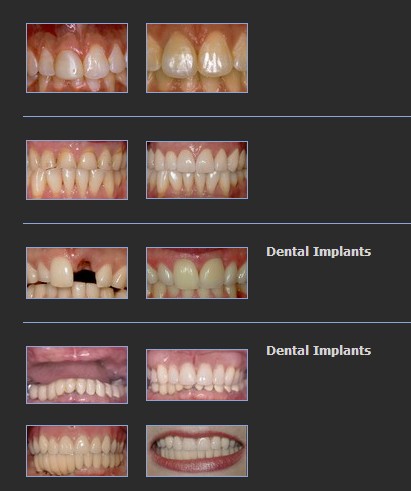 The stock smile gallery