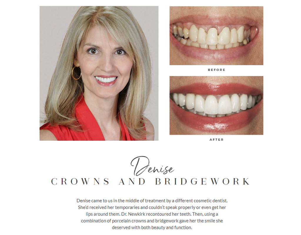 Building an effective smile gallery