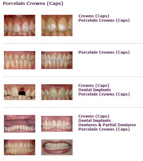 Dr. Cheung stock smile gallery from Prosites