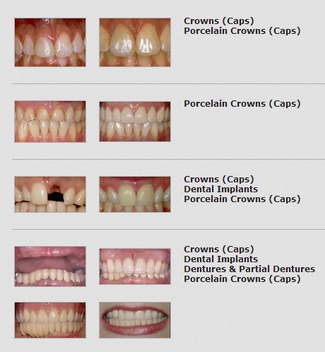 Rideau Stock smile gallery from Prosites